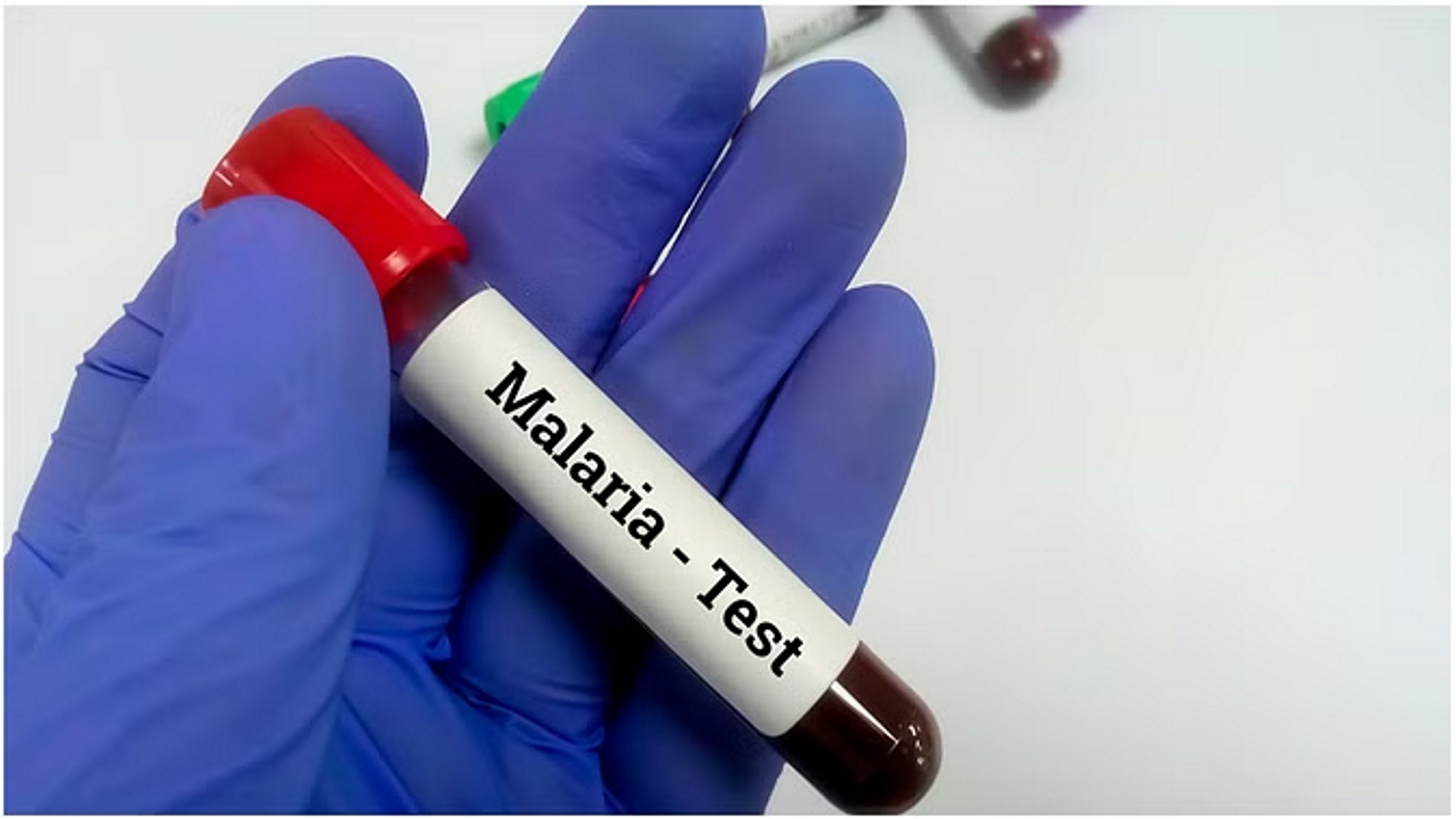 मलेरिया से लड़ने में अफ्रीकी देशों की मदद कर रहे भारत-ब्रिटेन